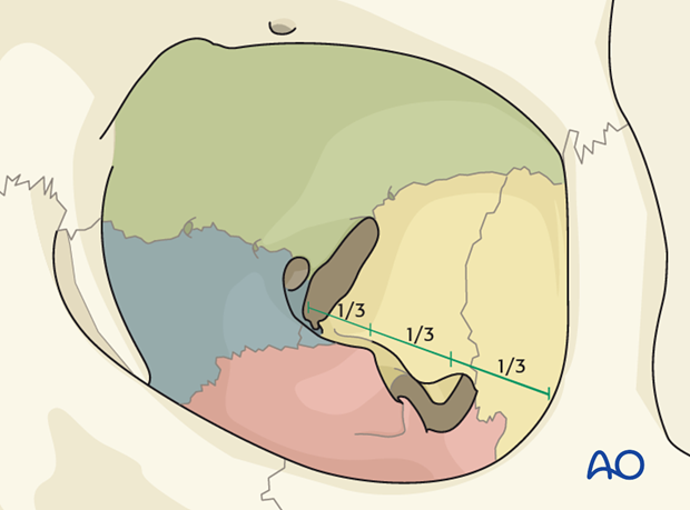 bony anatomy of the orbit