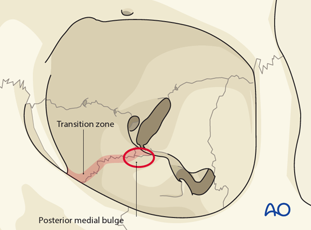 bony anatomy of the orbit