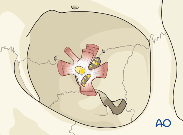 periorbital dissection introduction