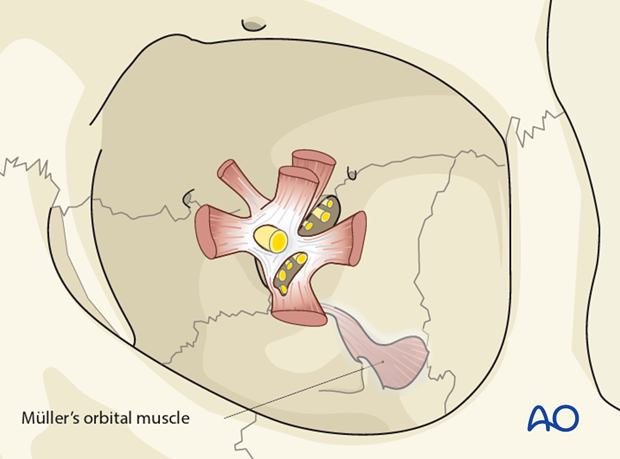 periorbital dissection introduction