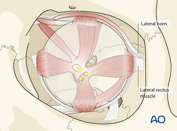 periorbital dissection introduction