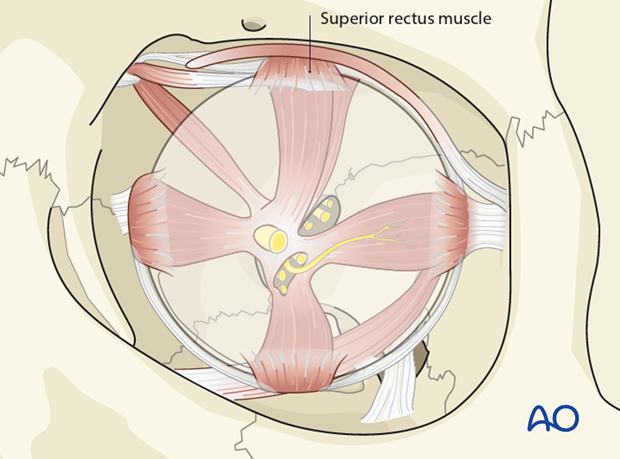 periorbital dissection introduction