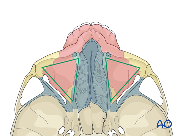 bony anatomy of the orbit