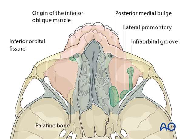 bony anatomy of the orbit