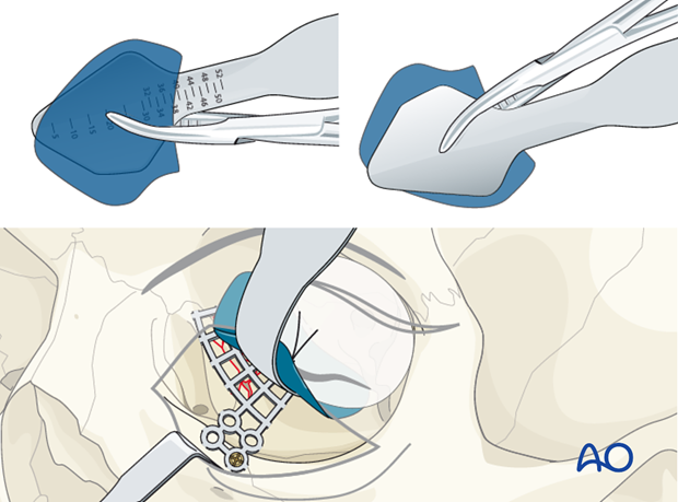 preoperative considerations