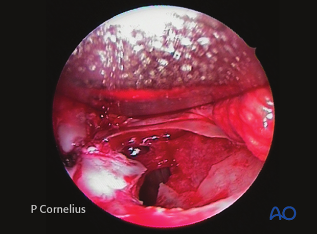 preoperative considerations