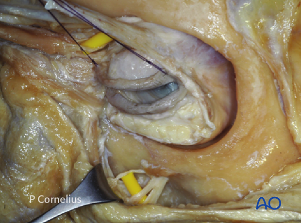 periorbital dissection introduction