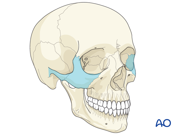 AOCMF Classification Midface (Level 1 and 2)