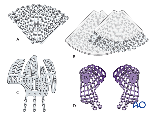 choice of implants