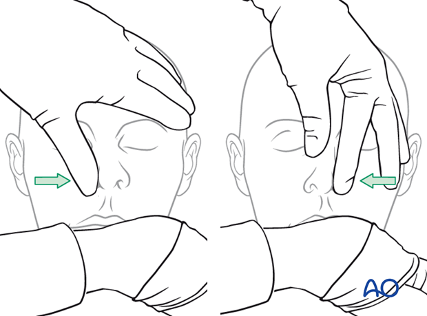 examination of patients with midfacial injuries