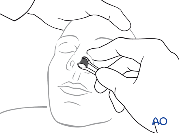 examination of patients with midfacial injuries