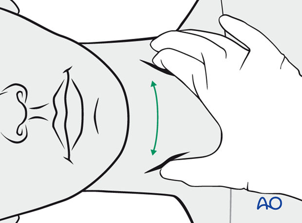 examination of patients with midfacial injuries