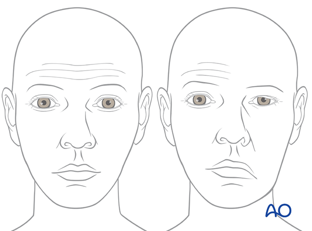 examination of patients with midfacial injuries