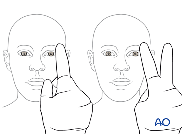 examination of patients with midfacial injuries