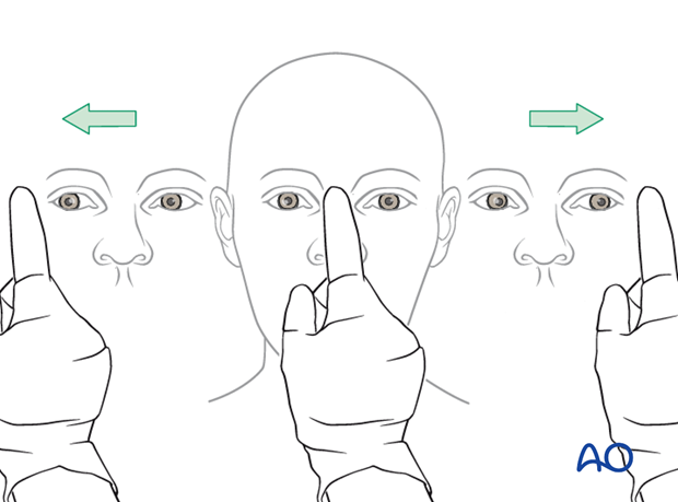 examination of patients with midfacial injuries