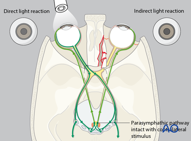 examination of patients with midfacial injuries