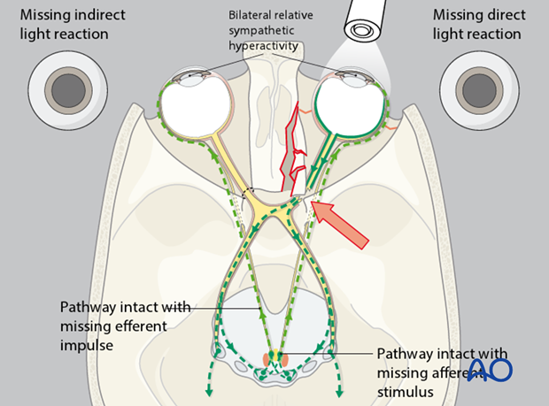 examination of patients with midfacial injuries