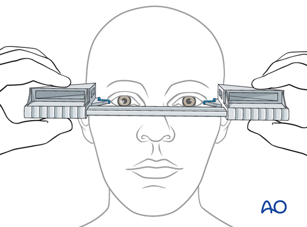 examination of patients with midfacial injuries