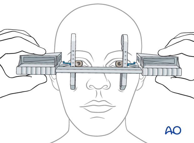 examination of patients with midfacial injuries