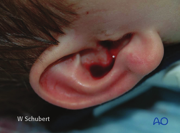 examination of patients with midfacial injuries