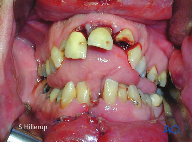 examination of patients with midfacial injuries