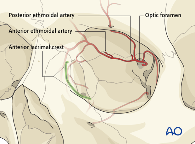 Extended glabellar approach