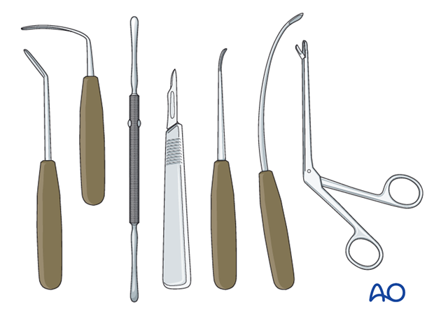 Endoscopic approach to the anterior table