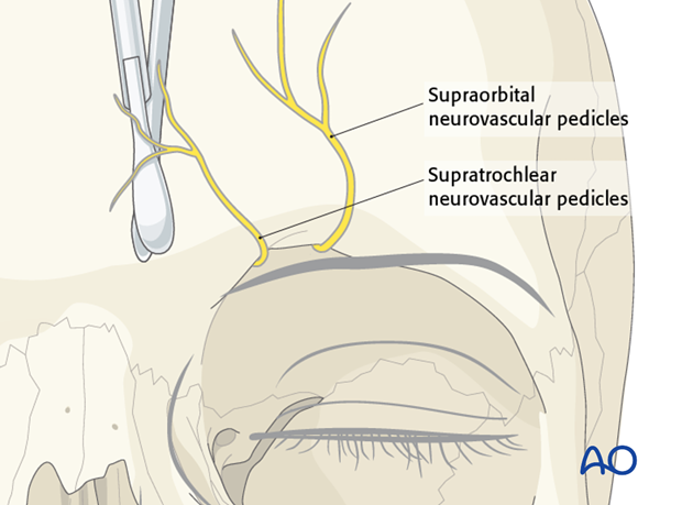 Endoscopic approach to the anterior table