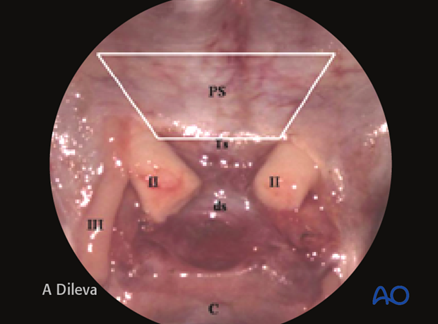 Endoscopic approach to the central skull base