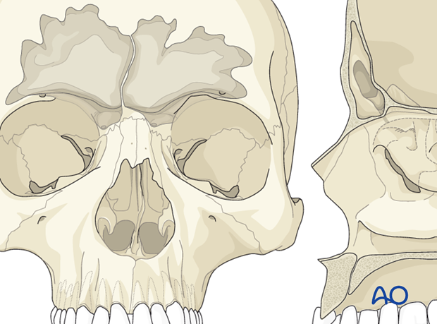 Defining the sinus margin