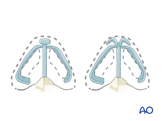 Nose Reconstruction by Dr. Frederick J Menick