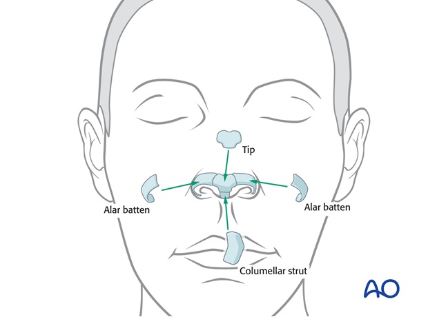 Nose Reconstruction by Dr. Frederick J Menick