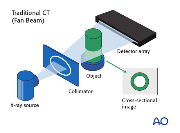 cone beam vs fan beam ct