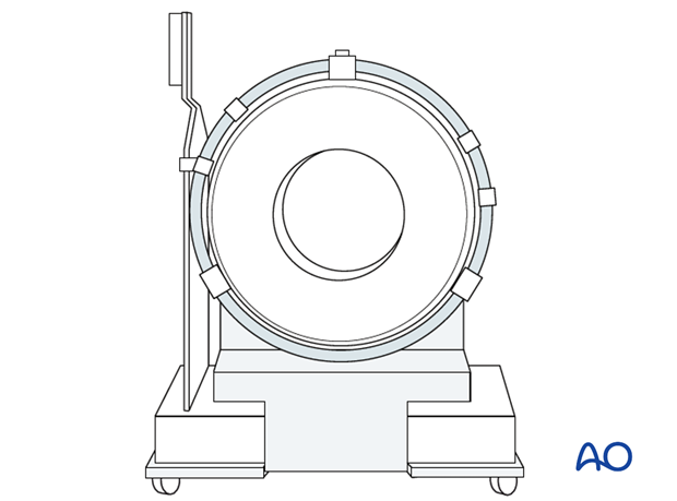 cone beam vs fan beam ct