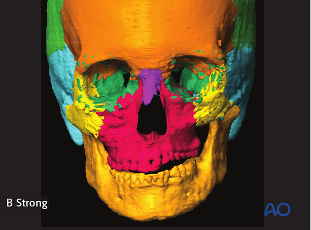 CAS computer assisted surgery