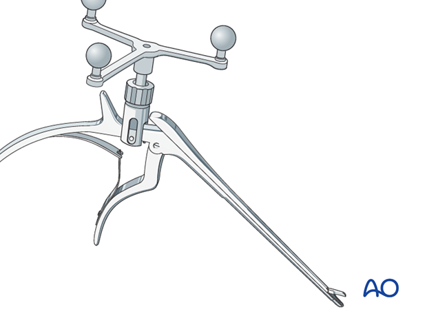 CAS preparation for intraoperative navigation