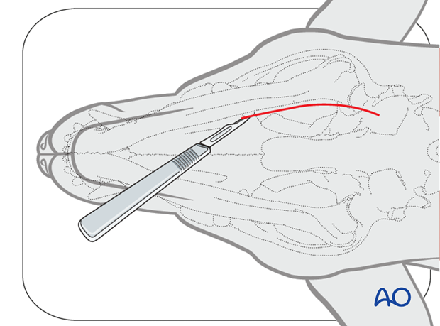 Ventral approach to caudal mandible skin incision|alt