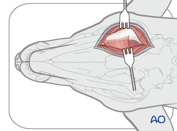 Ventral approach to caudal mandible anatomical exposure|alt