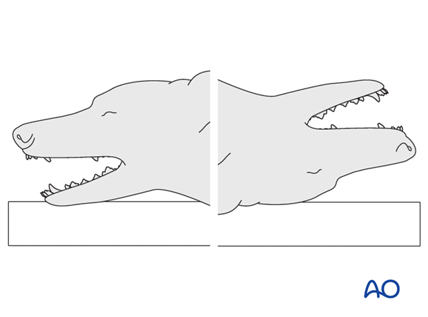 Intraoral approach ventral dorsal recumbency|alt