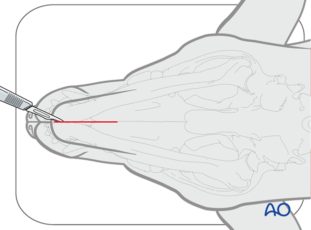 Ventral approach to rostral mandible skin incision|alt