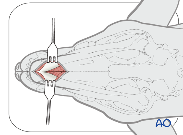 Ventral approach to rostral mandible skin incision|alt