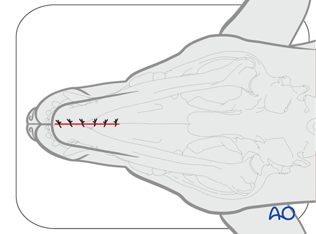 Ventral approach to rostral mandible closure|alt