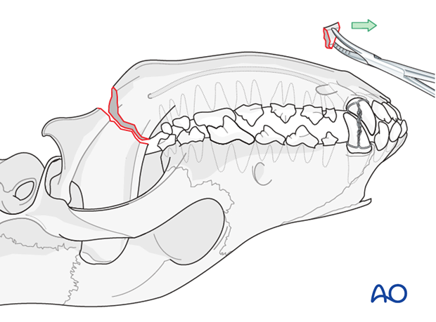 plate fixation