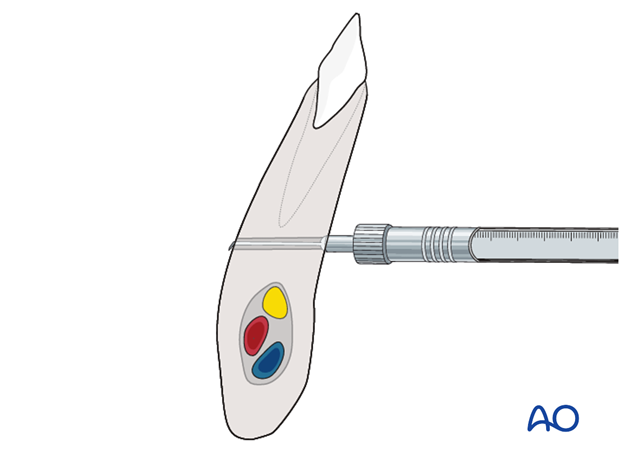 Dog mandible screw length measurement