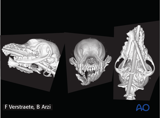 complications with mandible fractures