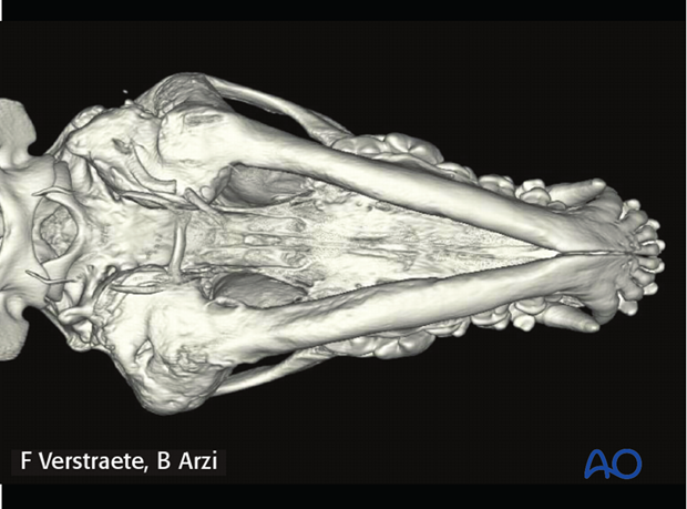 complications with mandible fractures