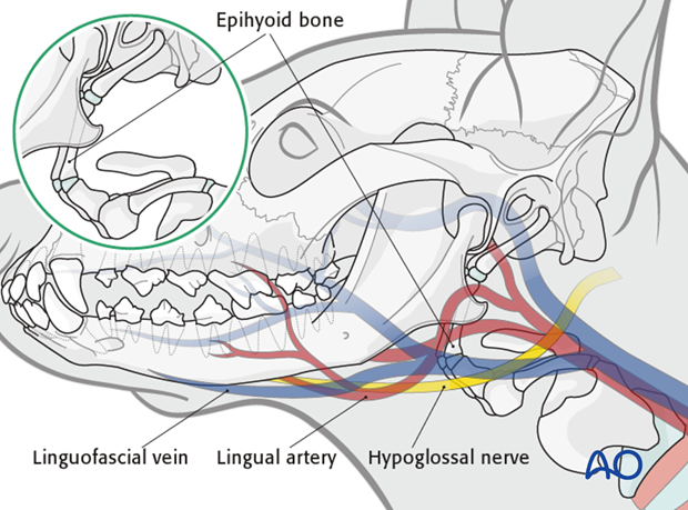 pharyngostomy intubation