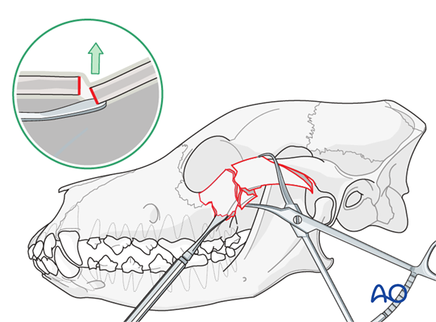 plate fixation