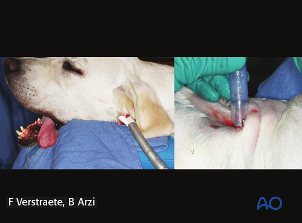 general considerations with midface fractures