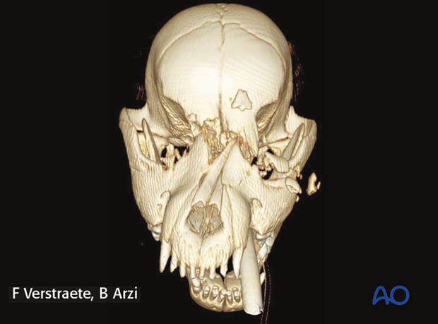 management of fractures in the pediatric patient